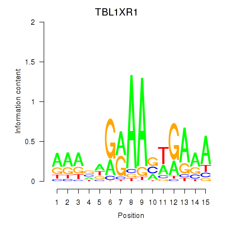 logo of TBL1XR1